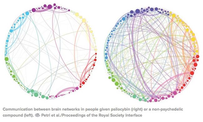 Which brain activity would you rather have?